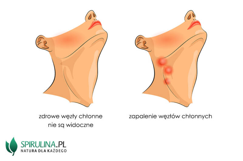 Zapalenie węzłów chłonnych algi Spirulina i Chlorella