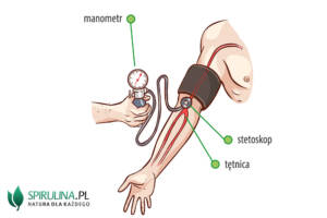 Hipotensja