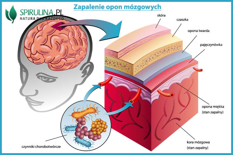 Zapalenie opon mózgowych algi Spirulina i Chlorella