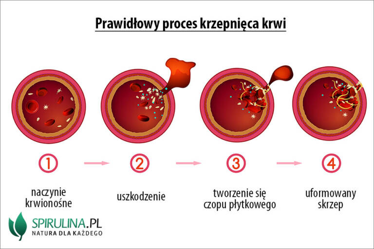 Zaburzenia Krzepnięcia Krwi Algi Spirulina I Chlorella 6575