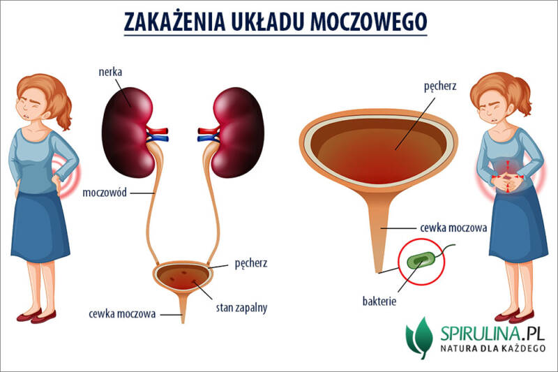 Zakażenia Układu Moczowego Algi Spirulina I Chlorella