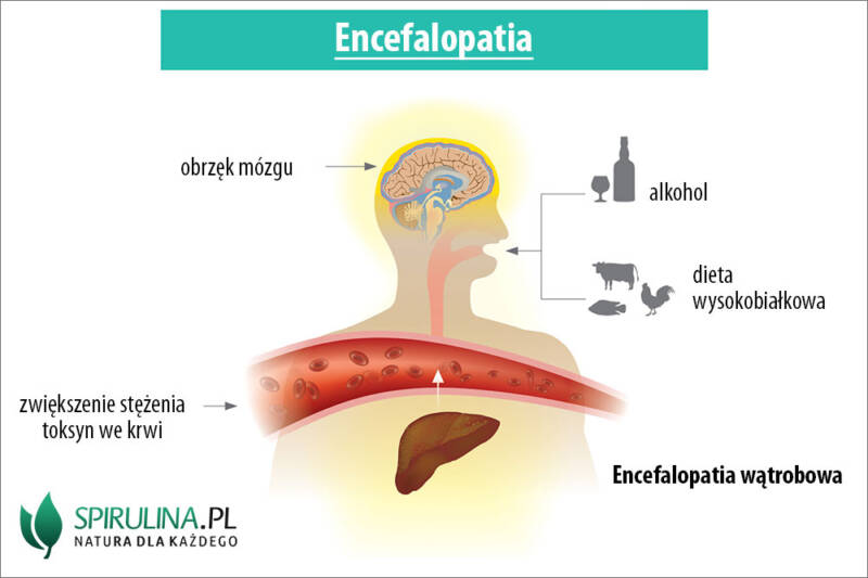 Encefalopatia Algi Spirulina I Chlorella 6046