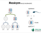 Mozaicyzm