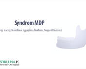 Syndrom MDP