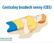 Centralny bezdech senny