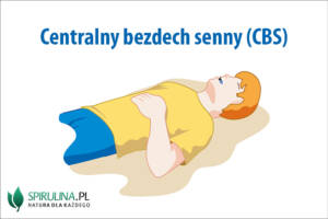 Centralny bezdech senny 