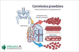 Czerwienica prawdziwa