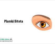 Plamki Bitota