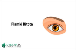 Plamki Bitota