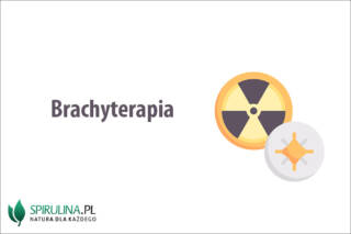 Brachyterapia
