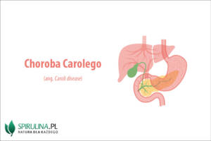 Choroba Carolego 