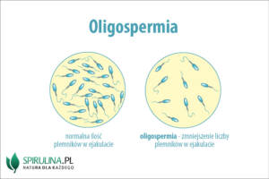 Oligospermia