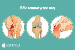 Bóle reumatyczne nóg