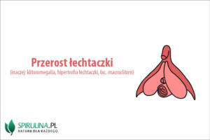 Przerost łechtaczki