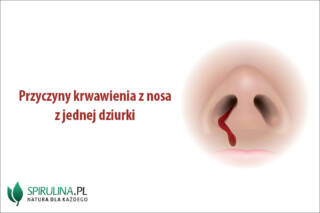 Przyczyny krwawienia z nosa z jednej dziurki