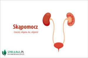 Skąpomocz