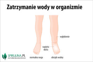 Zatrzymanie wody w organizmie