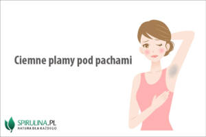 Ciemne plamy pod pachami