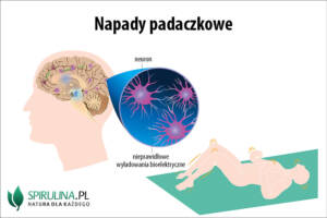 Napady padaczkowe