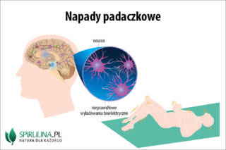 Napady padaczkowe