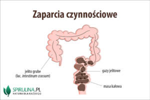 Zaparcia czynnościowe