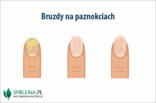 Bruzdy na paznokciach