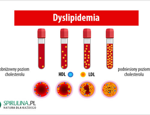 Dyslipidemia