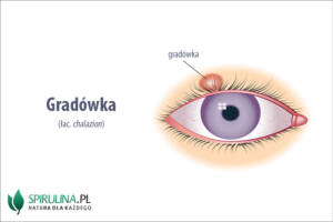 Gradówka