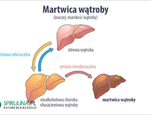 Martwica wątroby