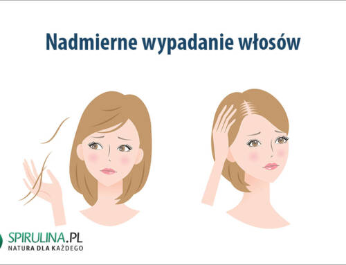 Nadmierne wypadanie włosów