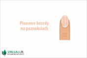 Pionowe bruzdy na paznokciach