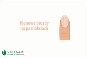 Pionowe bruzdy na paznokciach