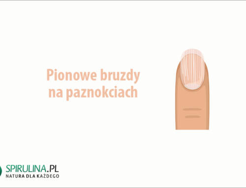 Pionowe bruzdy na paznokciach