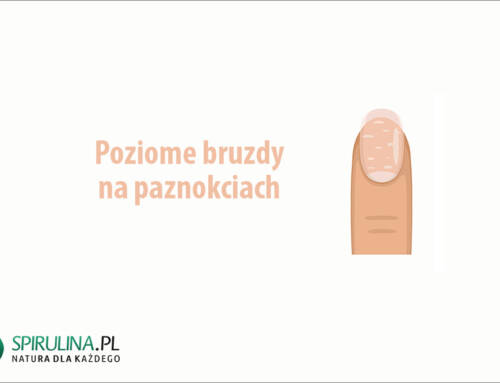 Poziome bruzdy na paznokciach