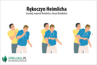 Rękoczyn Heimlicha