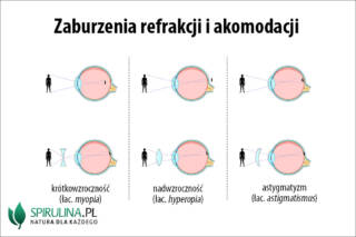 Zaburzenia refrakcji i akomodacji