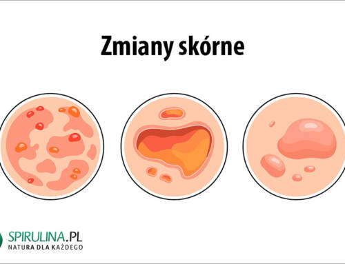 Zmiany skórne