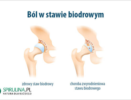 Ból w stawie biodrowym