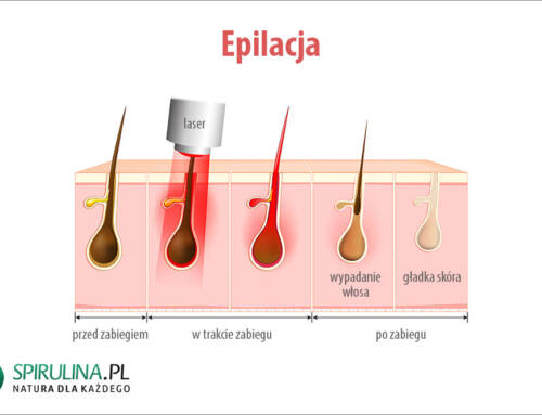 Epilacja