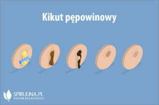 Kikut pępowinowy