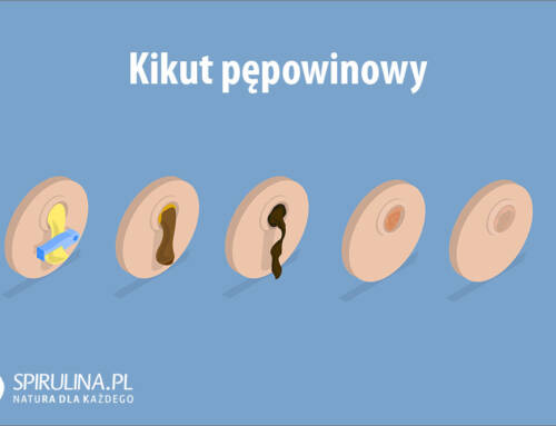 Kikut pępowinowy