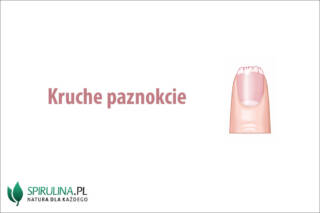 Kruche paznokcie