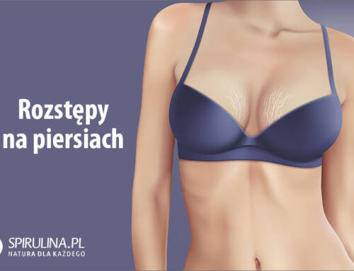 Rozstępy na piersiach