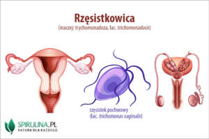 Rzęsistkowica