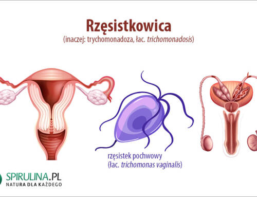 Rzęsistkowica