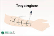 Testy alergiczne