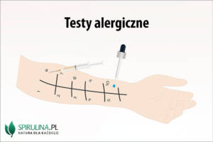 Testy alergiczne