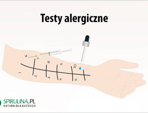 Testy alergiczne