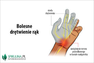 Bolesne drętwienie rąk