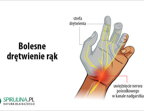 Bolesne drętwienie rąk